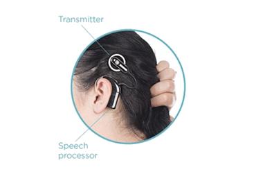 ENT180814_Cochlear-image-for-website-(14145
